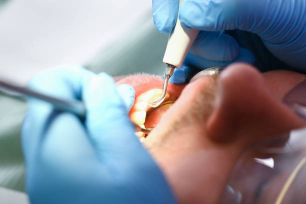 Best Same-Day Emergency Dental Services in Hughes Springs, TX