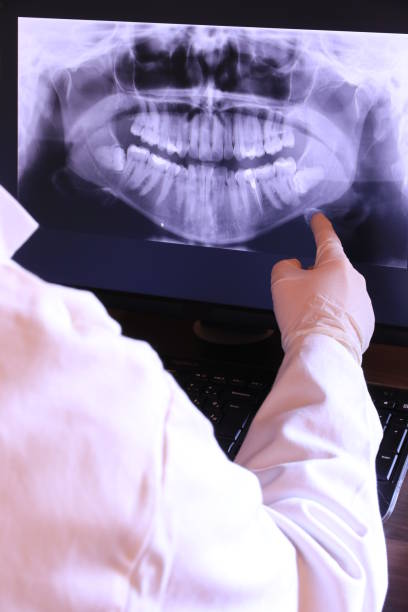Best Emergency Tooth Extraction in Hughes Springs, TX